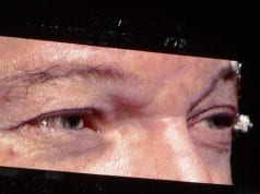 Il mistero delle tre canzoni “rubate” vasco rossi