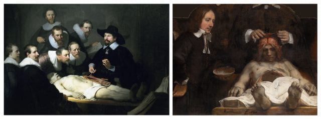 Rembrandt, La lezione di anatomia del dottor Tulp, 1632. A destra, La lezione di anatomia del dottor Leyman, 1656